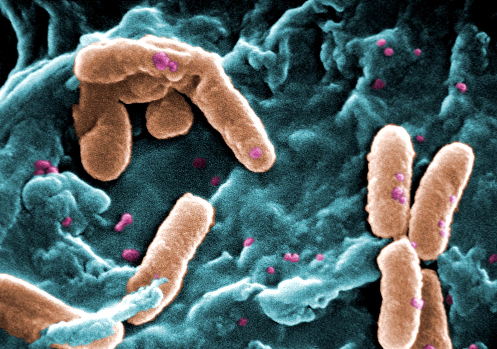 Electron microscope photo of bacteria. The bacteria are an off-pink color and their surrounding are a spectrum of blues.