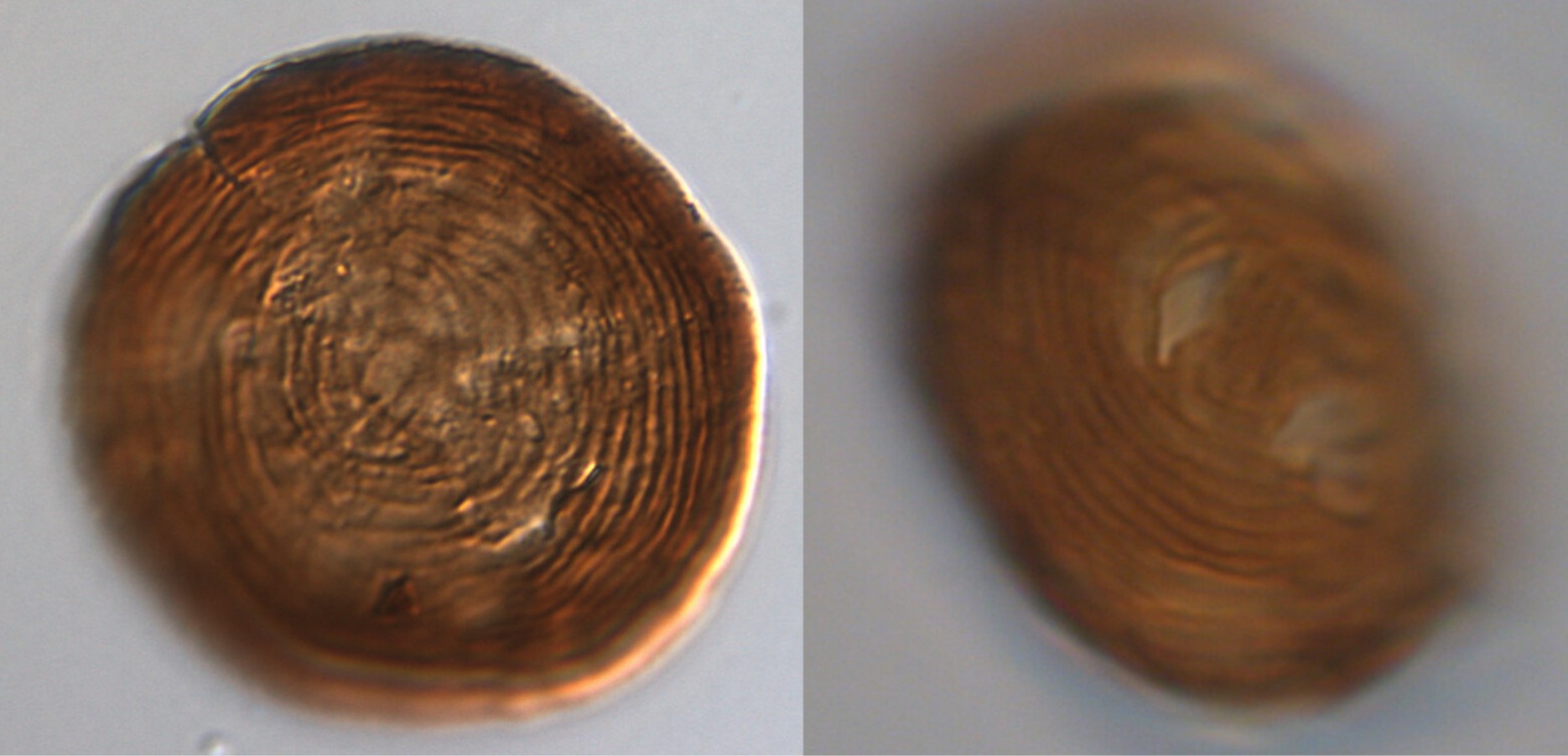 Photograph of a magnified fossil now understood to be an encysted Euglenid