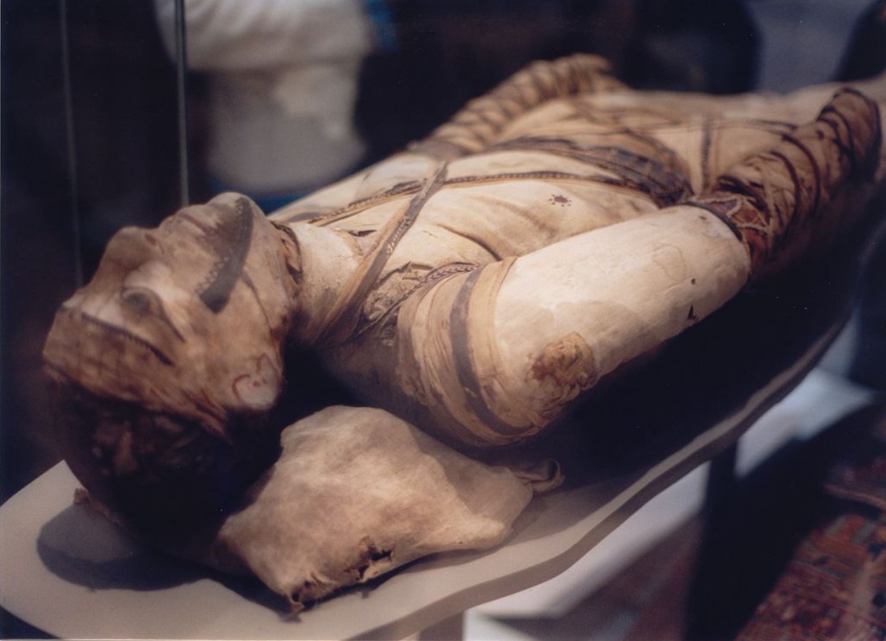 An Egyptian mummy in the British Museum with tubercular decay has been found in the spine