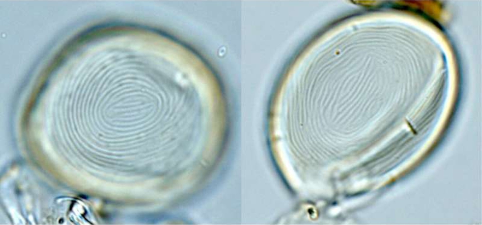 Photograph of an encysted Euglenid under a microscope