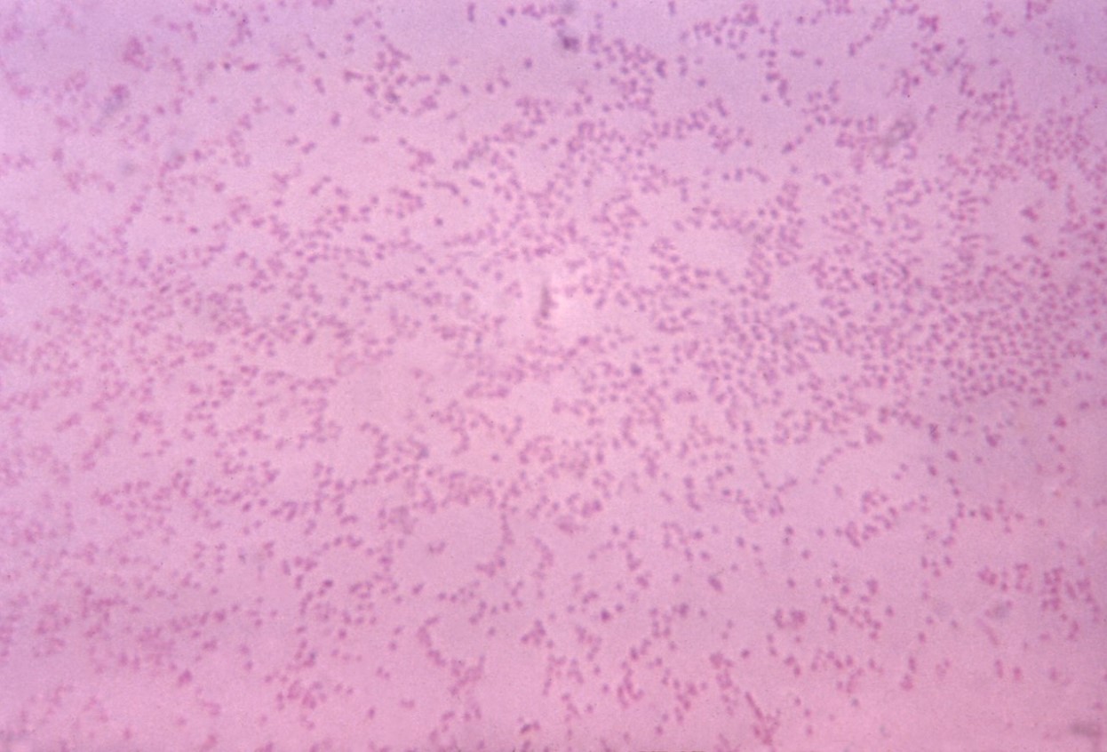 A magnified shot of numerous Pasteurella multocida bacteria