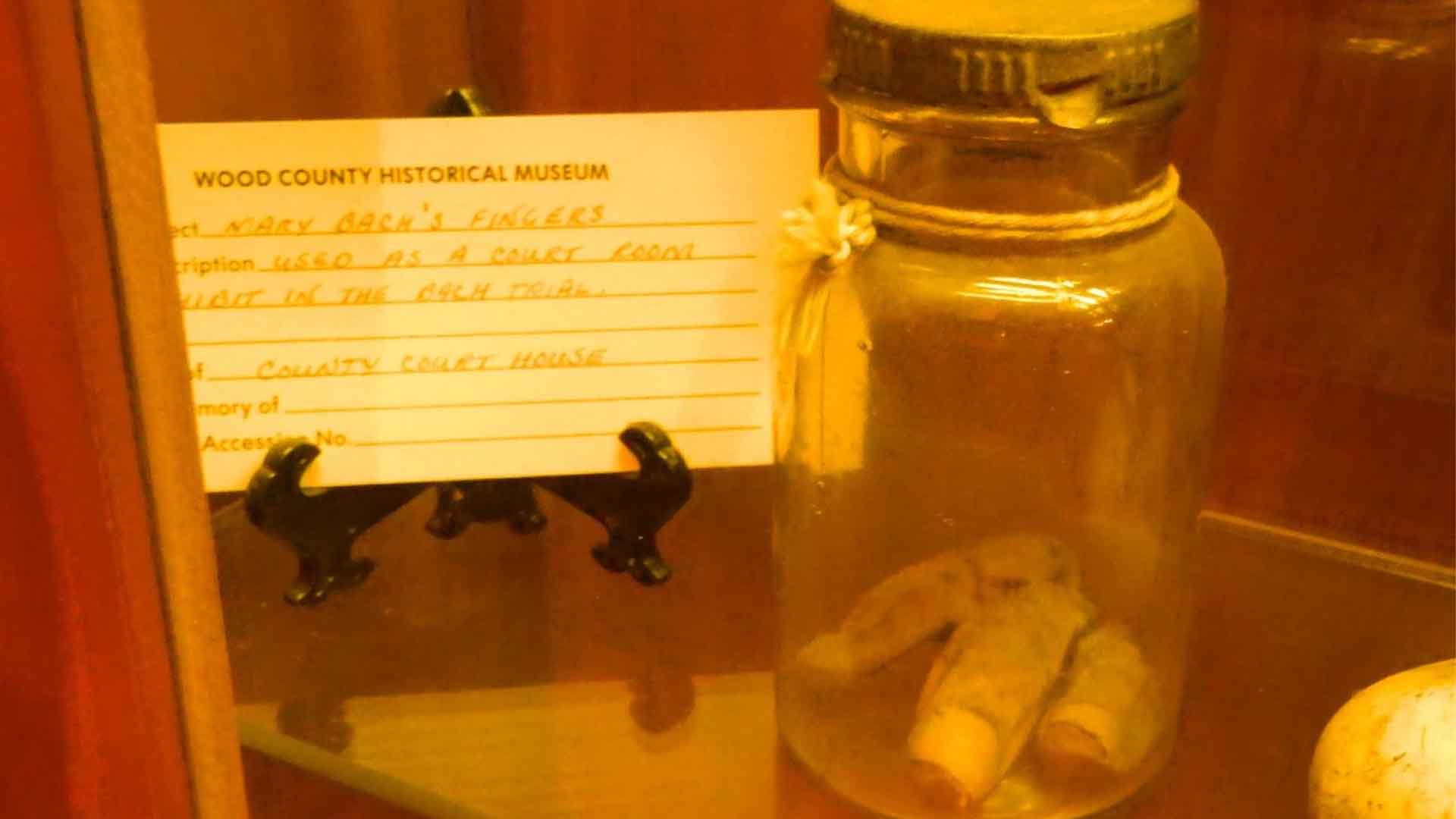 Mary Bach's fingers in a jar on display