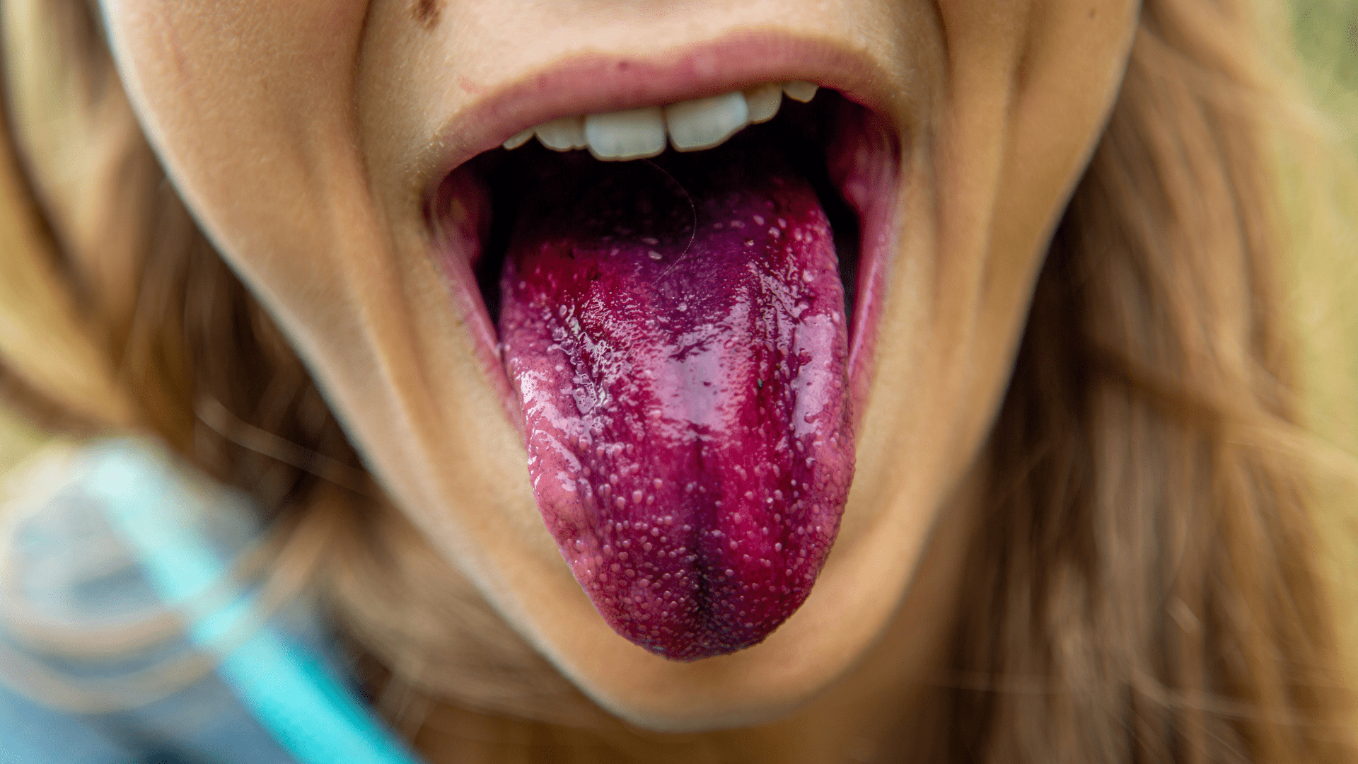 A close-up of a girl’s tongue, which she is sticking out of her mouth. It is covered in purple coloring.