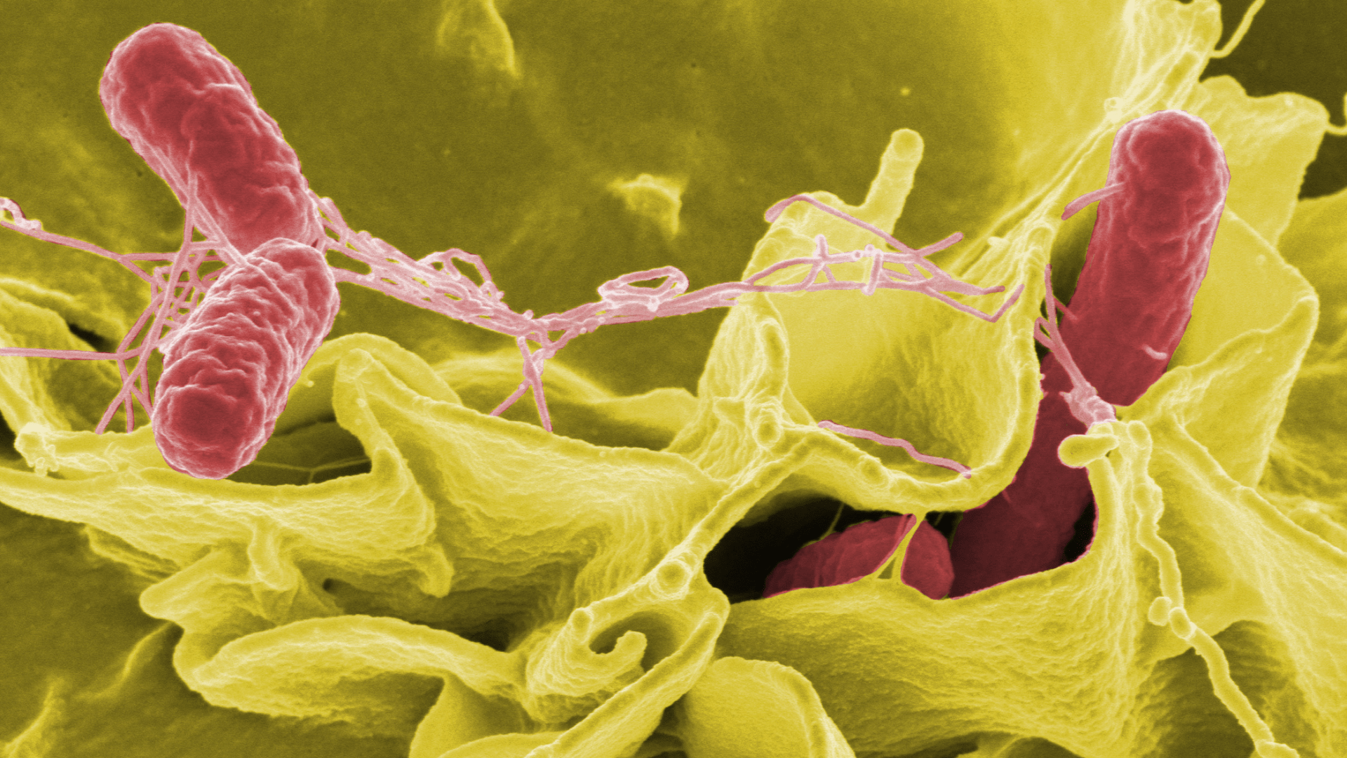 Color-enhanced scanning electron micrograph showing Salmonella invading human cells.