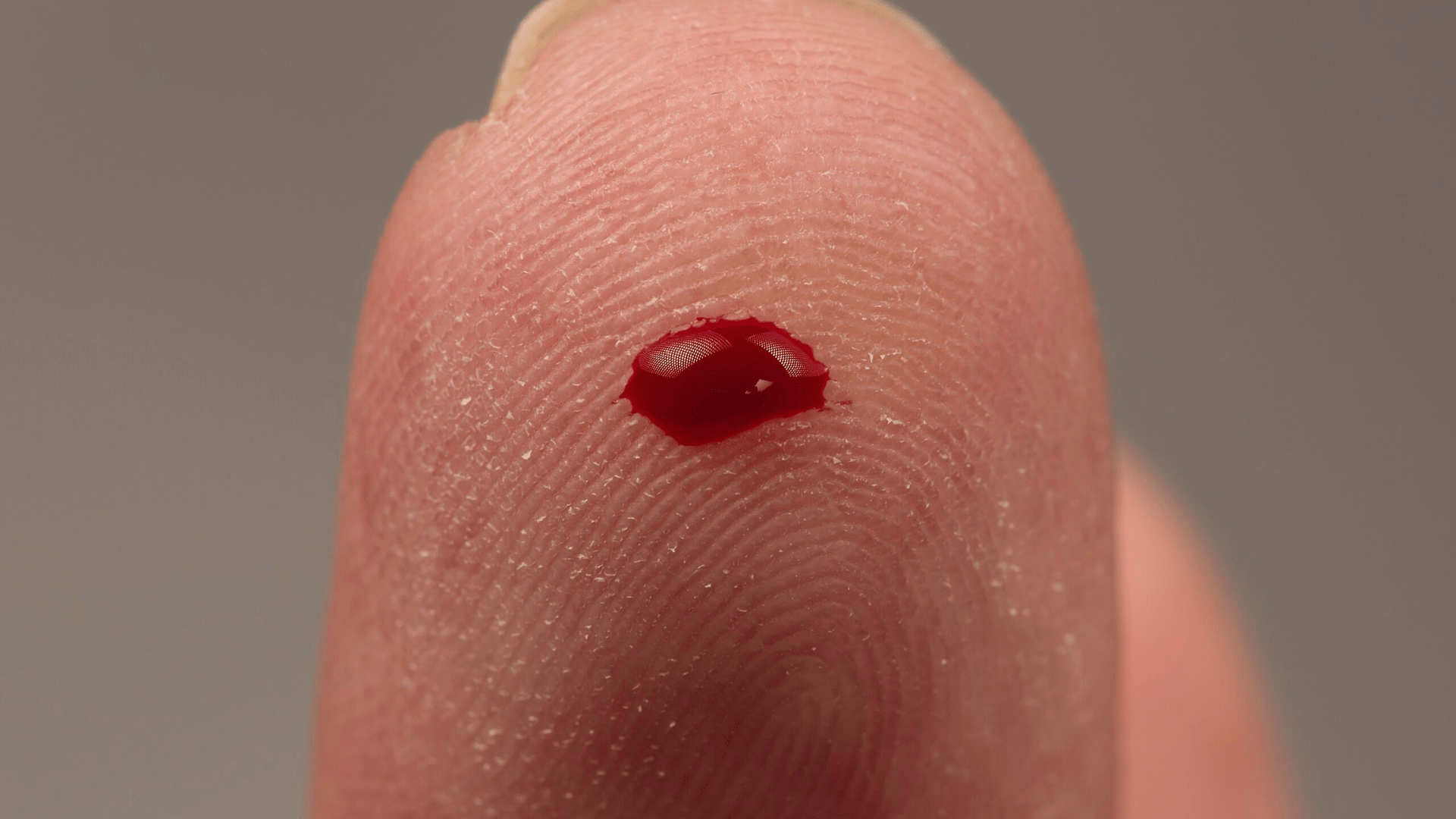 A close up of a dot of blood on a person’s finger.