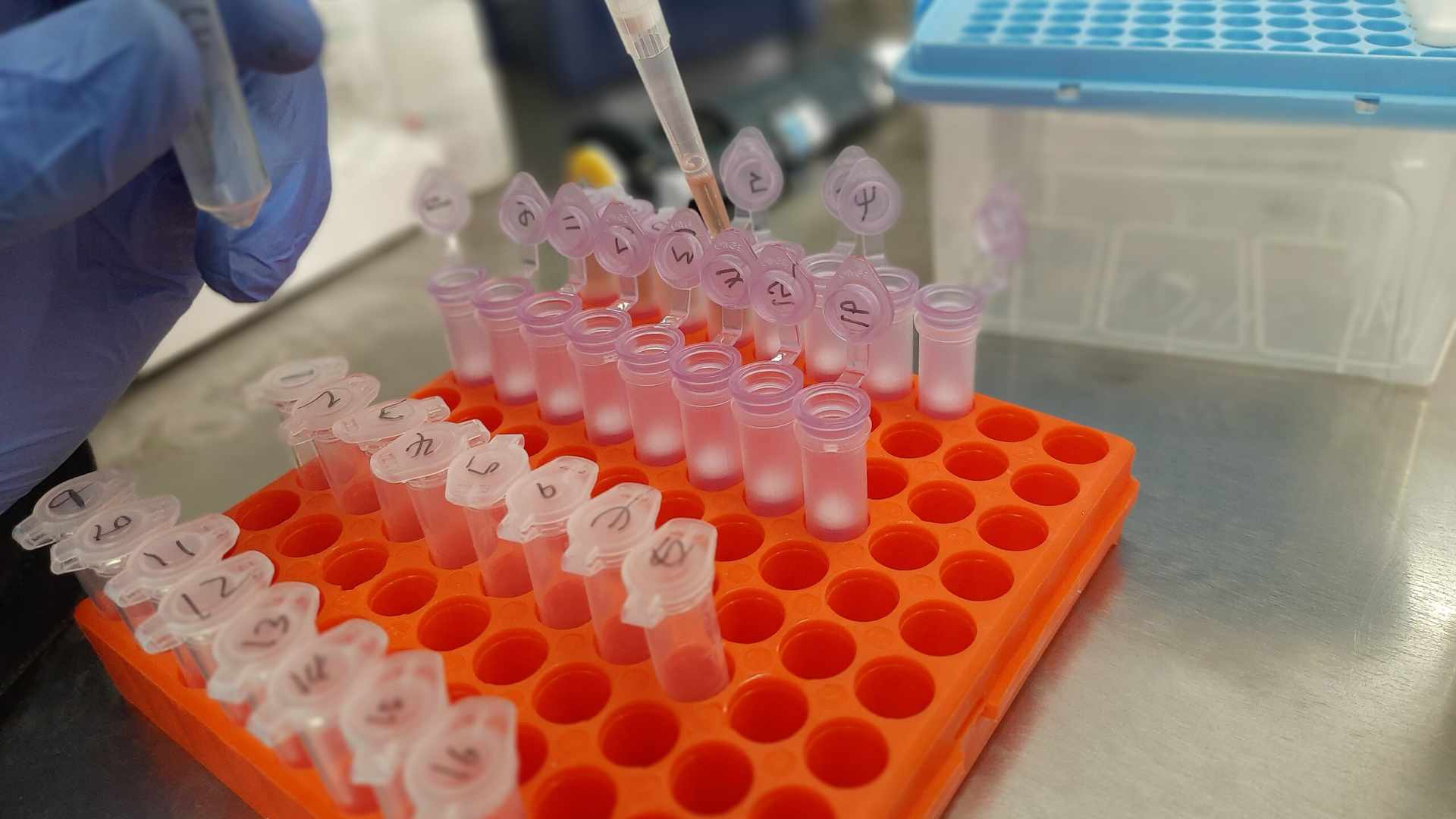 A scientist extracts DNA from Bacteria.