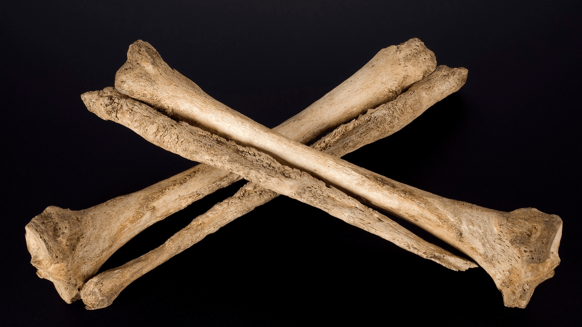Human leg bones in a crossed pattern.