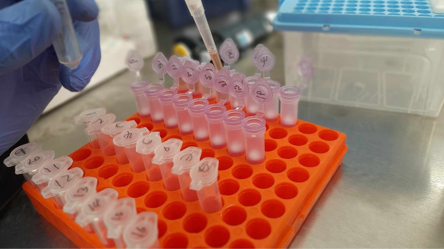 Bacteria from cultures is extracted as part of a DNA analysis.